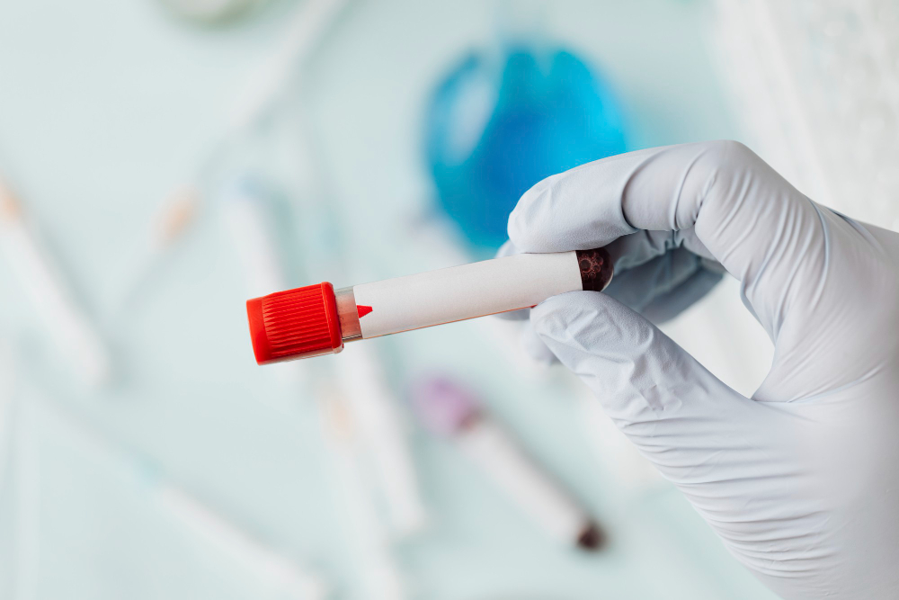 Understanding Your CBC Blood Test Results: A Complete Guide